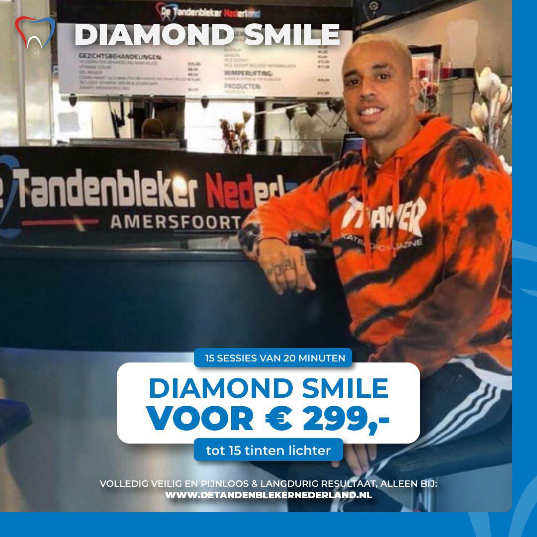 tanden-bleken-diamond-smile tanden bleken diamond smile
