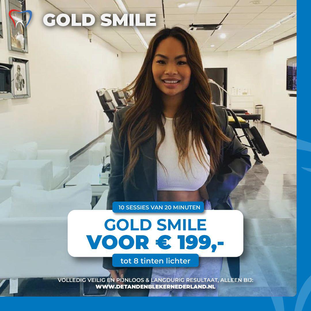 tanden-bleken-gold-smile tanden bleken gold smile